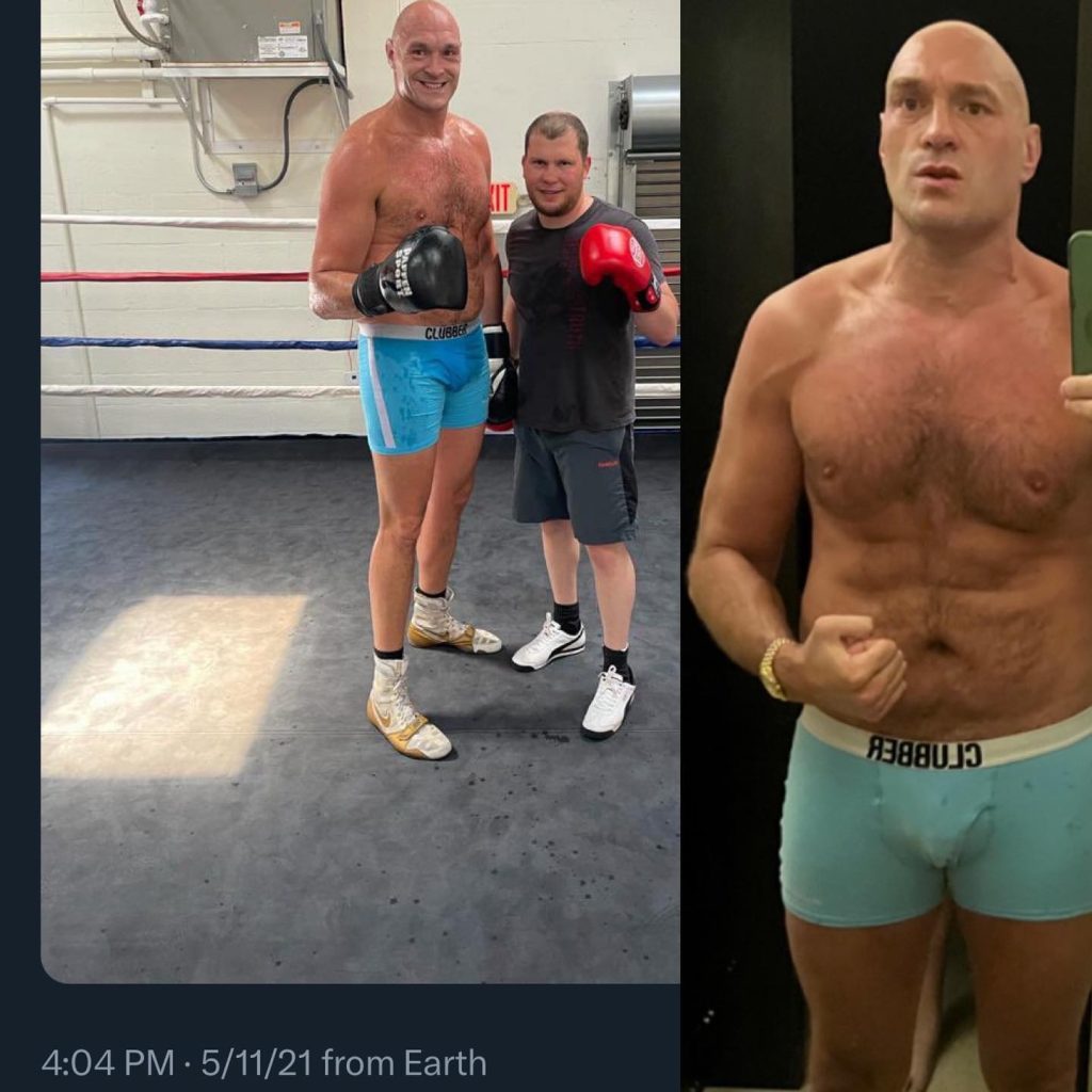  Tyson Fury age